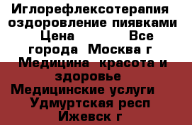 Иглорефлексотерапия, оздоровление пиявками › Цена ­ 3 000 - Все города, Москва г. Медицина, красота и здоровье » Медицинские услуги   . Удмуртская респ.,Ижевск г.